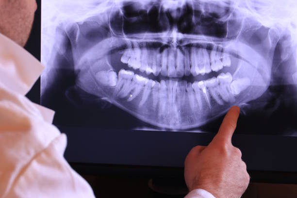 Best Chipped Tooth Repair Near Me  in Albuquerque, NM